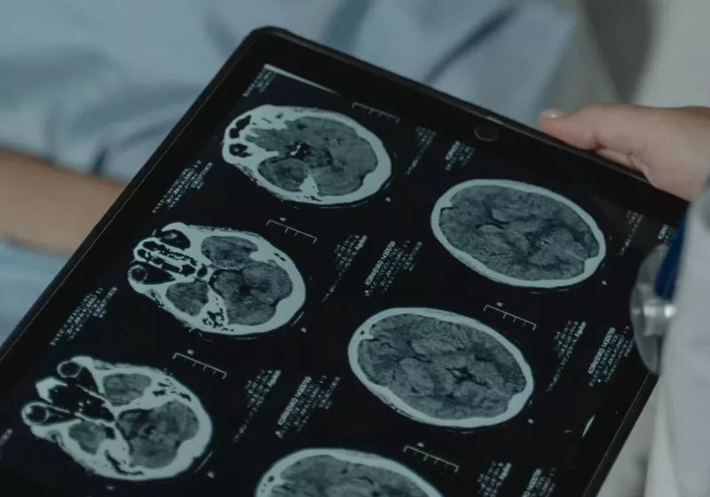 bilim insanlari genetik duzenleme yoluyla kanser hucrelerinin kendi kendini yok etmesini sagladi UWuvgp3J