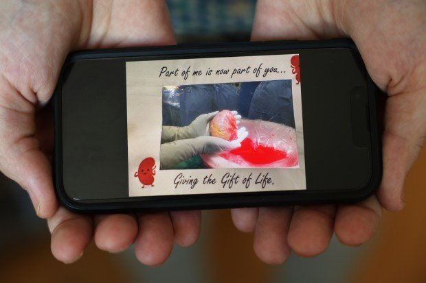 John Nicholas displays a picture on his phone of the living donor kidney he received from a friend for transplant. (John J. Kim/Chicago Tribune)